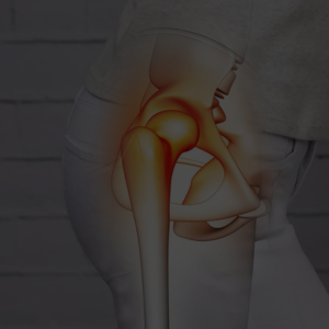 Hip Pain & Injury