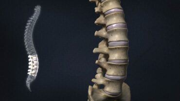 Bones: An Orthopedic Surgeon’s Perspective